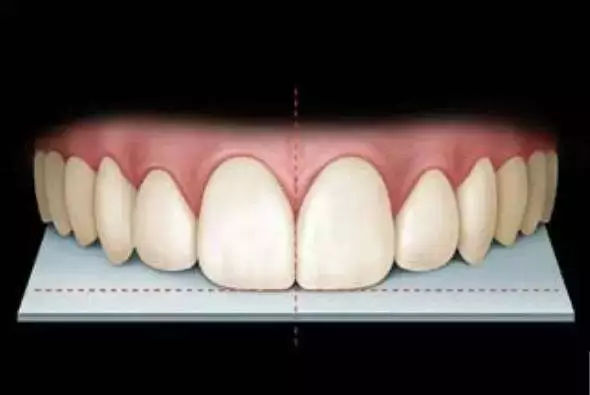 哈爾濱牙齒矯正 哈爾濱牙齒矯正