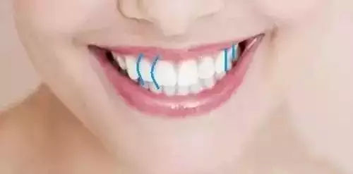 哈爾濱牙齒種植 哈爾濱牙齒種植