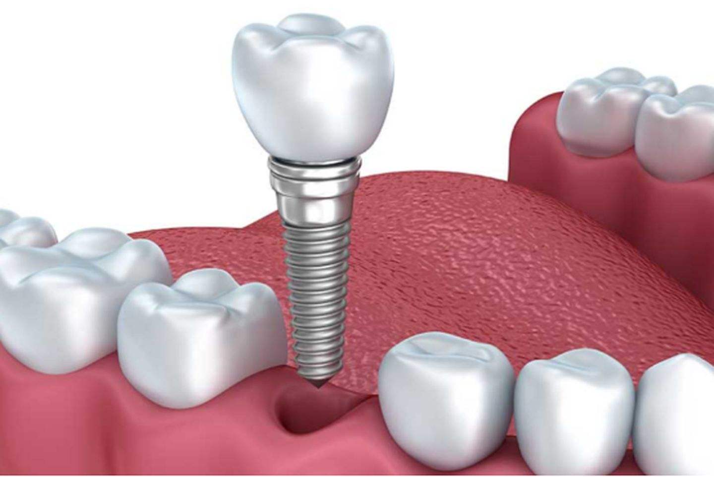 哈爾濱牙科診所 哈爾濱牙科診所